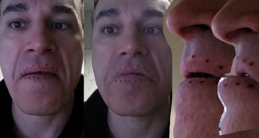 not from a single front camera the lip appears the same, but from the side the difference is huge.