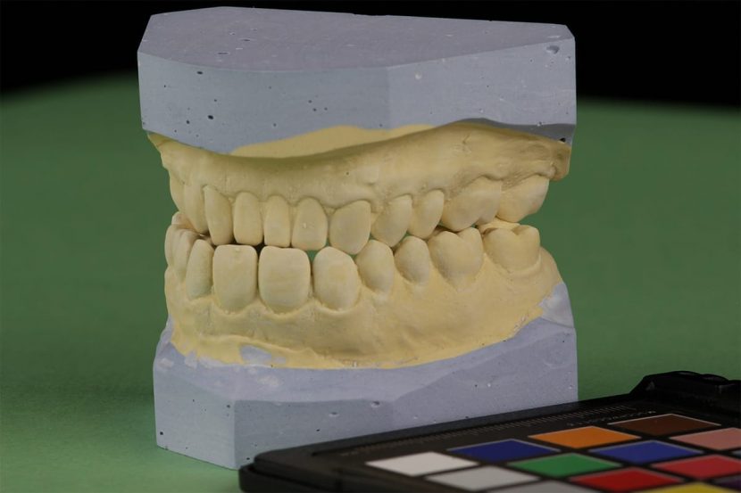 Dominic Monaghan's teeth mold.